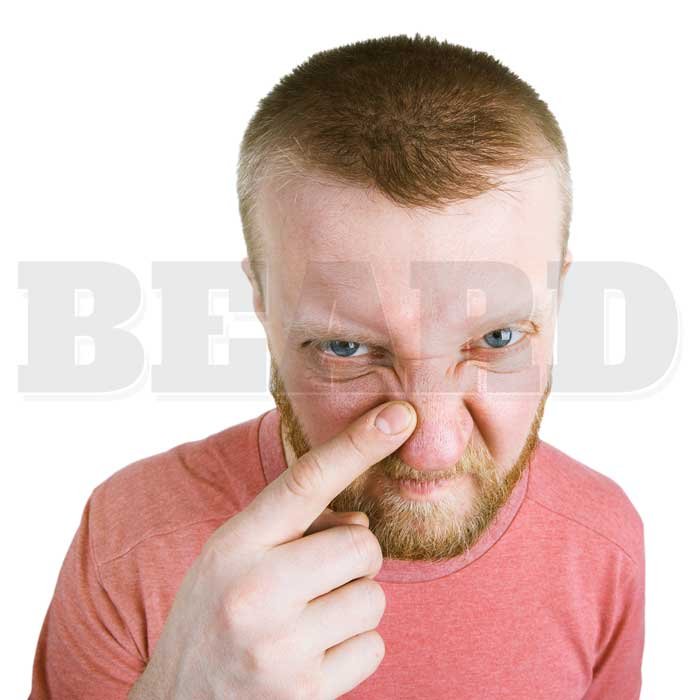 Cravos e suas marcas pequenas, mas irritantes no rosto de um homem barbudo