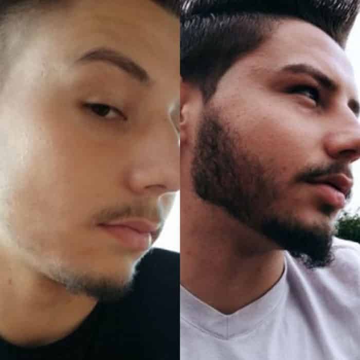antes e depois