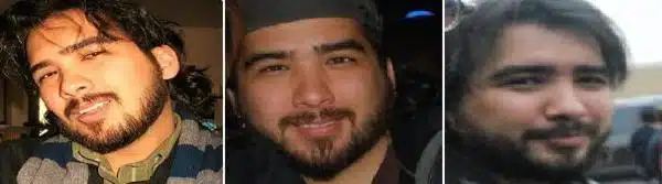 minoxidil para a barba antes e depois 2