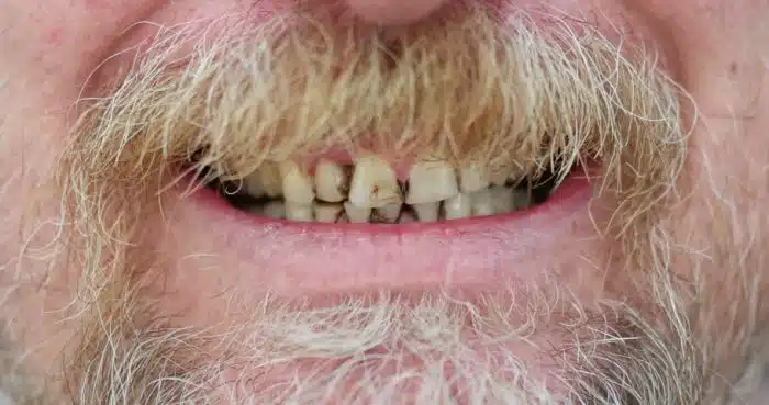grooming e os dentes sujos