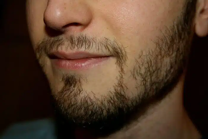 é possível resolver uma barba falhada com Biotina, mas é preciso cautela