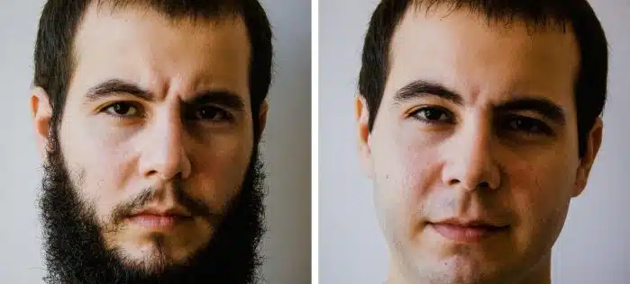 Medicamentos que fazem os pelos faciais crescerem é uma das grandes Mentiras sobre a Barba