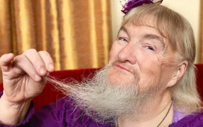 Esta é uma Estatística sobre barba estranha: ela tem a maior barba feminina do mundo