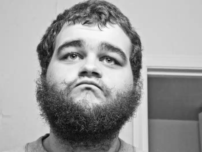 A raiva e o estresse também causam a queda de Fios da Barba