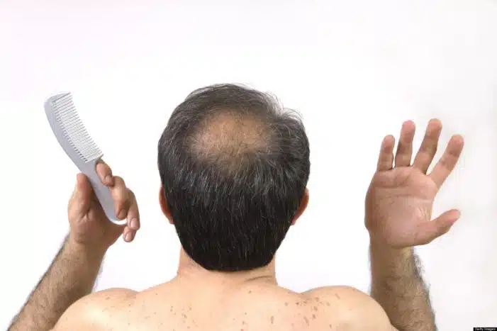 A Queda de Cabelo vem de diversos fatores