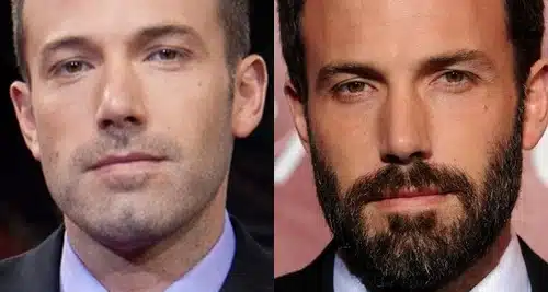 A barba melhora muito o homem Ben Affleck