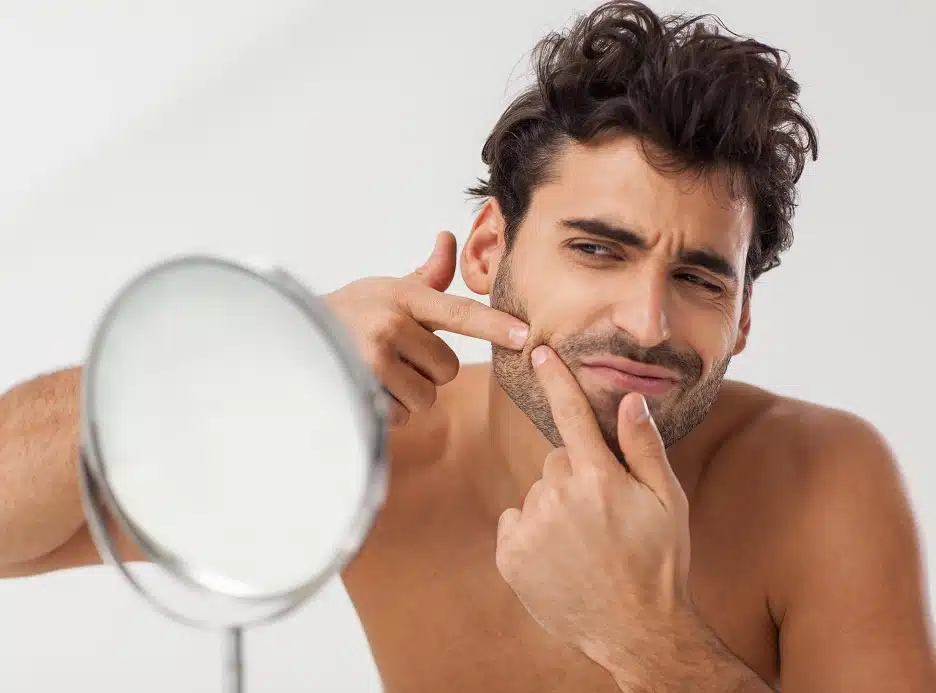 Quais são os problemas da Foliculite na Barba?