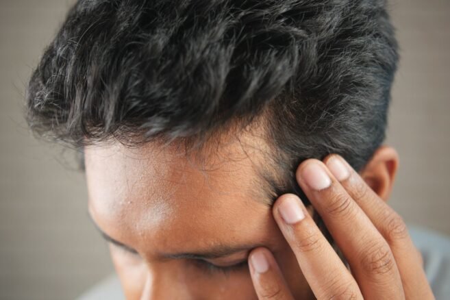 Homem passando a mão no couro cabeludo perto da linha do cabelo